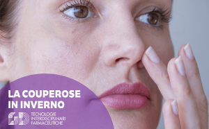 couperose in inverno rimedi