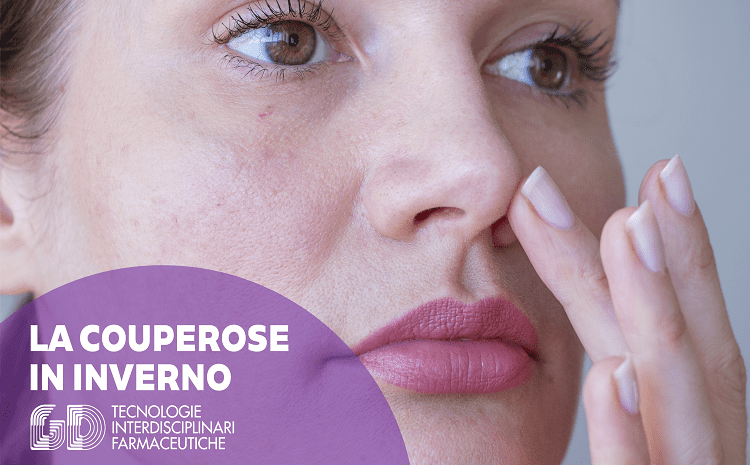 couperose in inverno rimedi